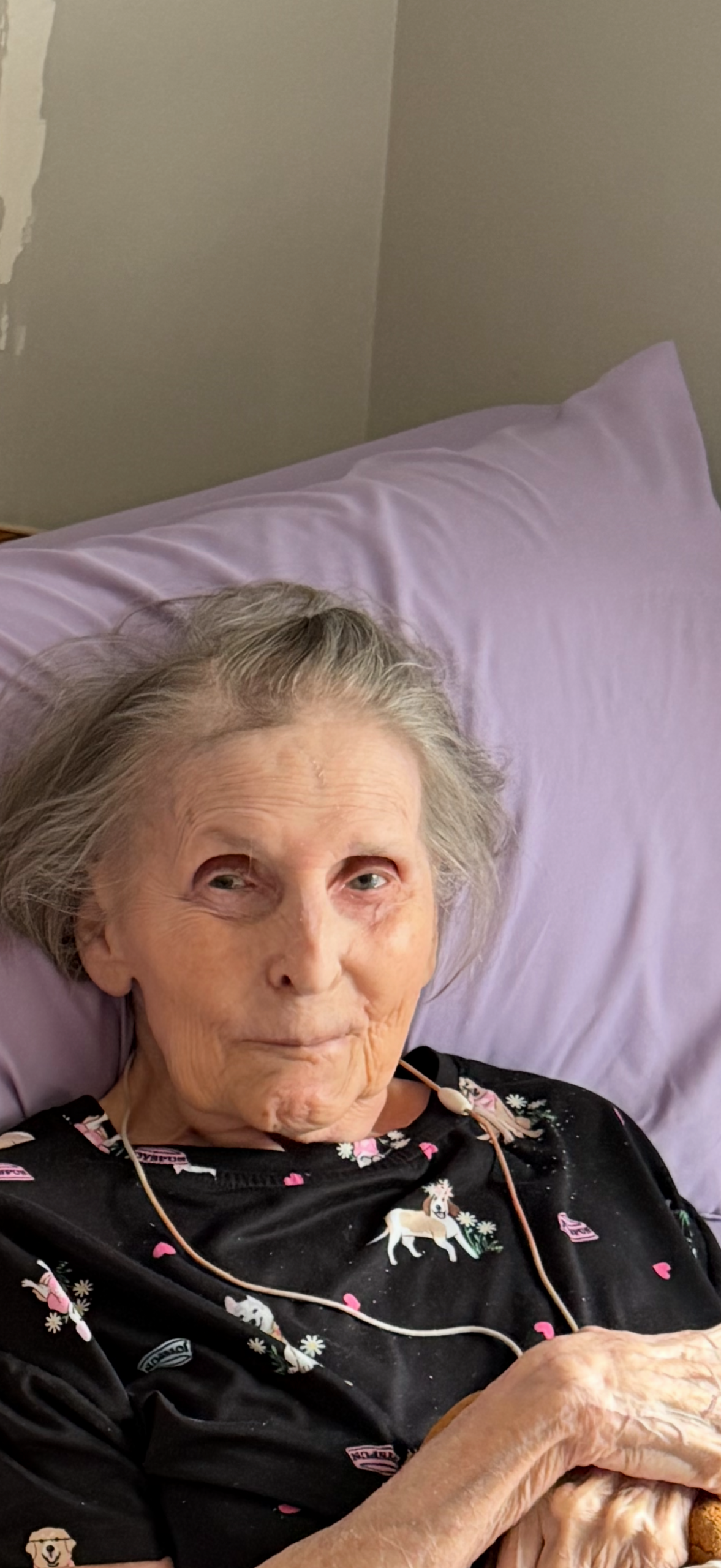 Elderly woman resting in bed on a lavender pillow, wearing a dark, horse-patterned top with a light tubing around her neck.