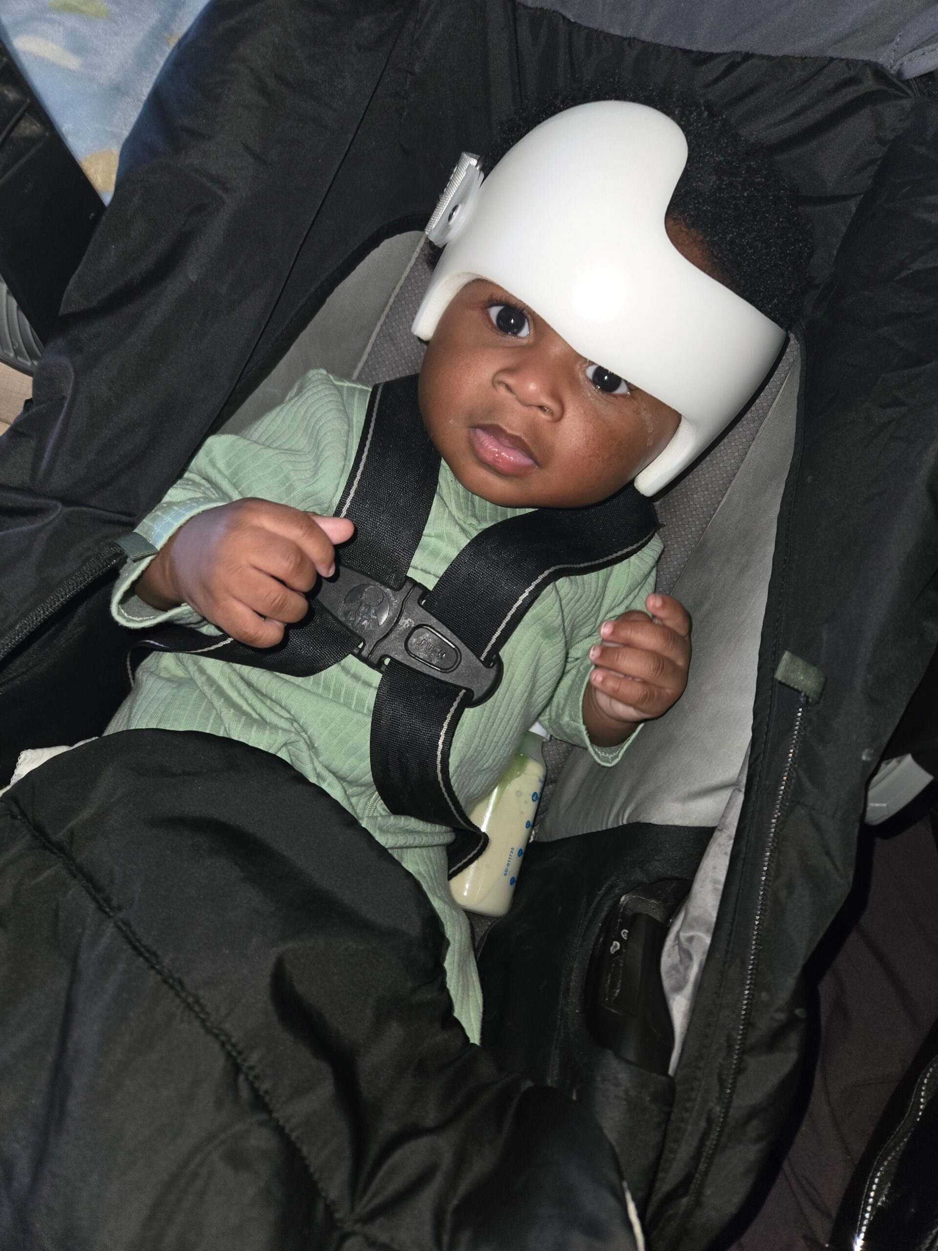 Baby in a car seat wearing a white protective headgear, strapped in with a green outfit behind a black cover.