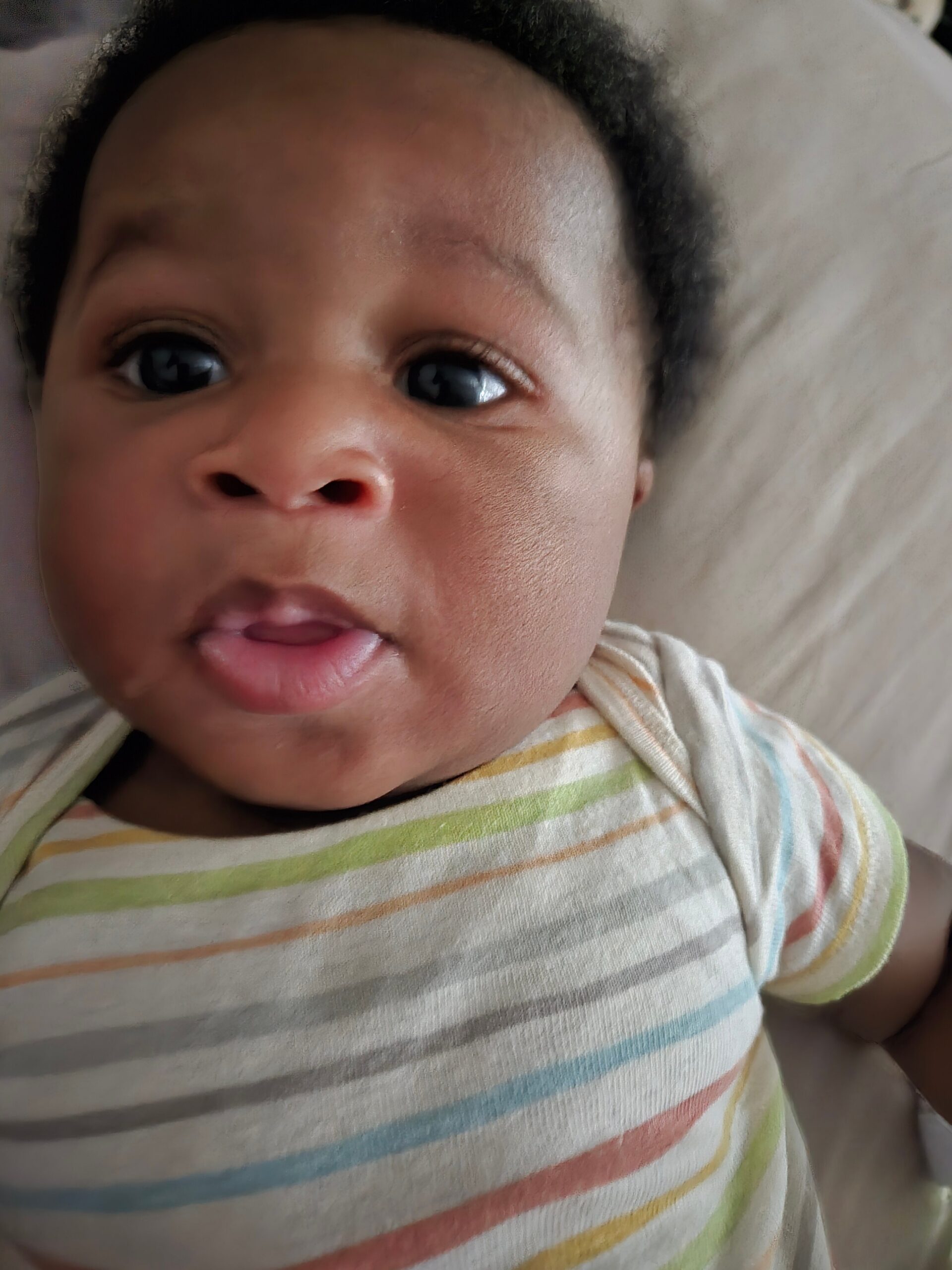 Close-up of a baby’s face with dark eyes, wearing a pastel-striped onesie, lying on a light surface.