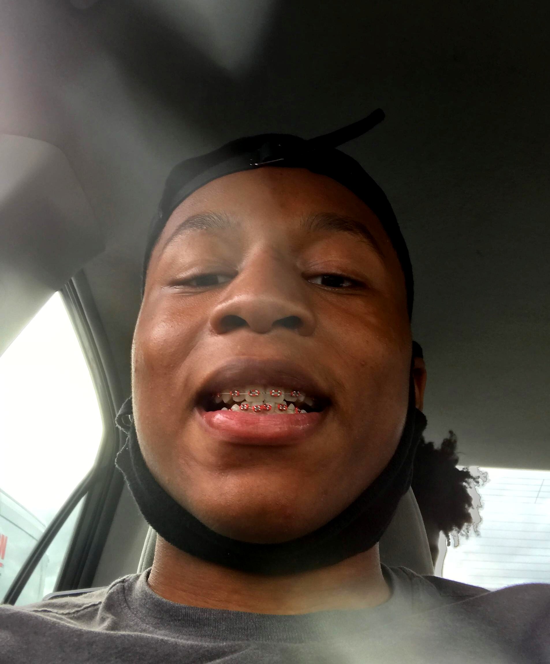 Close-up of a person smiling in a car, showing braces with red elastics on their teeth, wearing a black head covering.