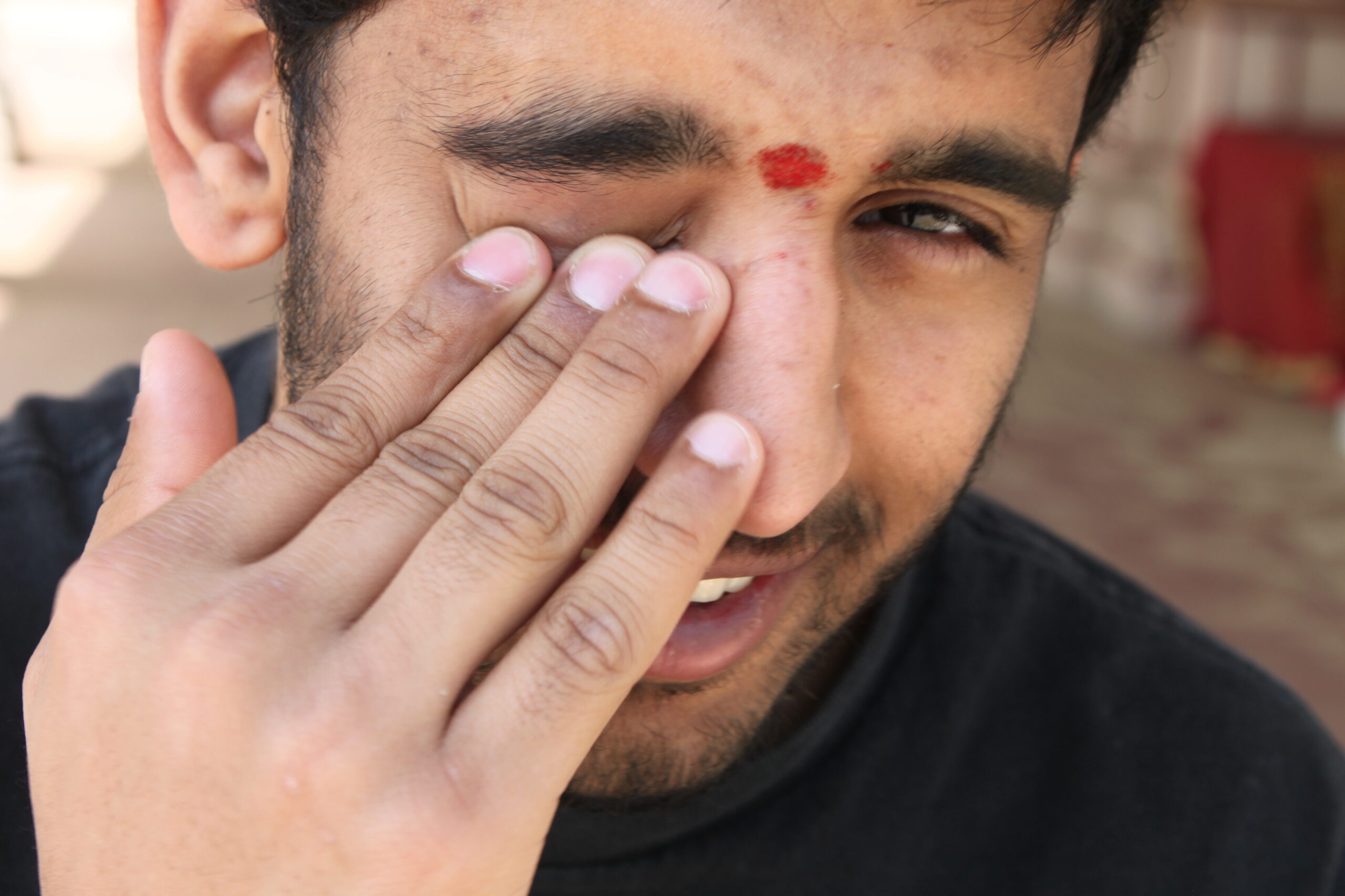 Close-up of a person squeezing their eye with fingers, a small red spot is visible above the eyebrow.